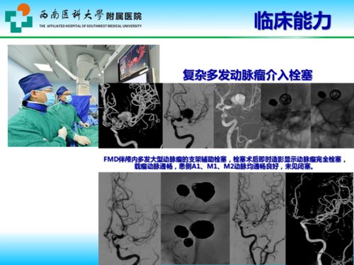 学科领航 平台赋能 四川省神外临床医学研究中心建设与发展——西南医大附院陈礼刚团队的医学研究探索
