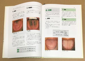 舌诊と脈診 中医臨床における実践的アプローチの再検討